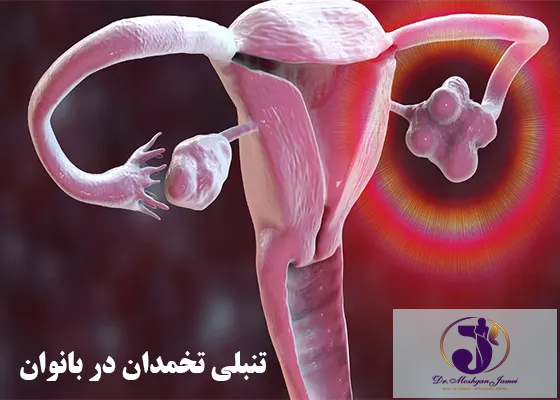 تنبلی تخمدان در بانوان