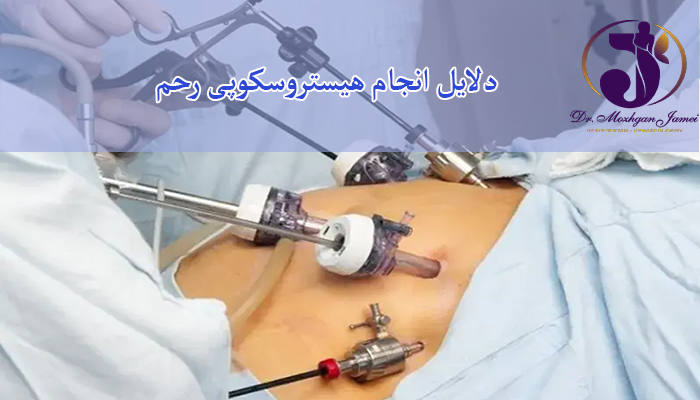 دلایل انجام هیستروسکوپی رحم