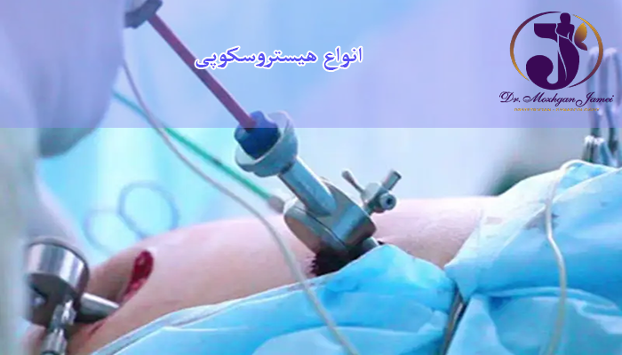 هیستروسکوپی چیست