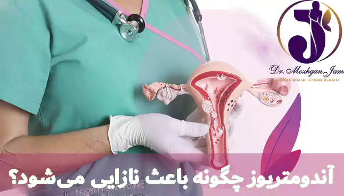 آندومتریوز چگونه باعث نازایی می‌شود؟