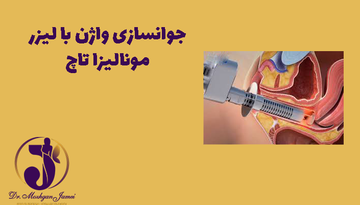 جوانسازی واژن با لیزر مونالیزا تاچ