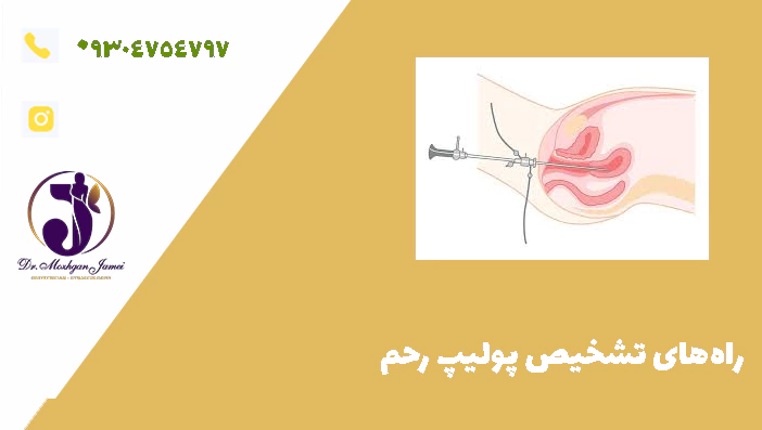 راه‌های تشخیص پولیپ رحم