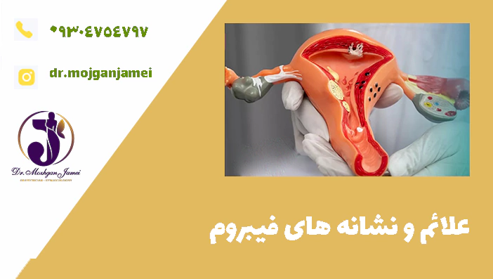 علائم و نشانه های فیبروم 