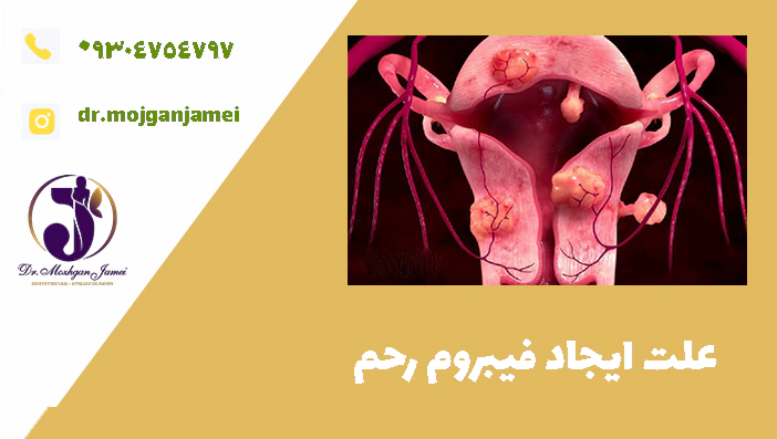علت ایجاد فیبروم رحم 