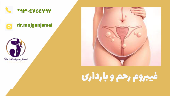 فیبروم رحم و بارداری