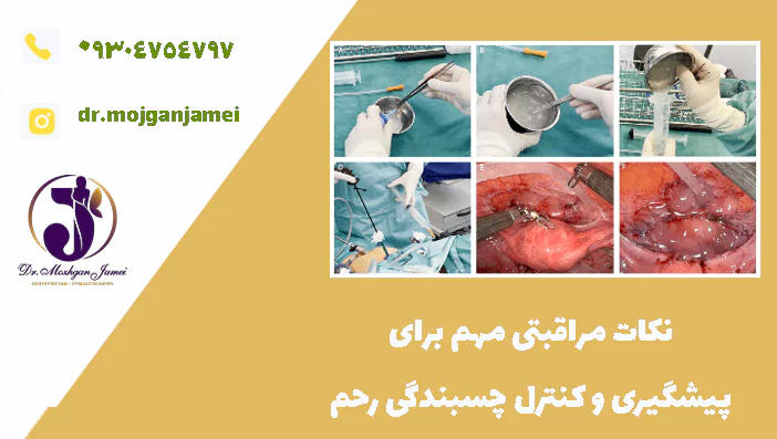 نکات مراقبتی مهم برای پیشگیری و کنترل چسبندگی رحم