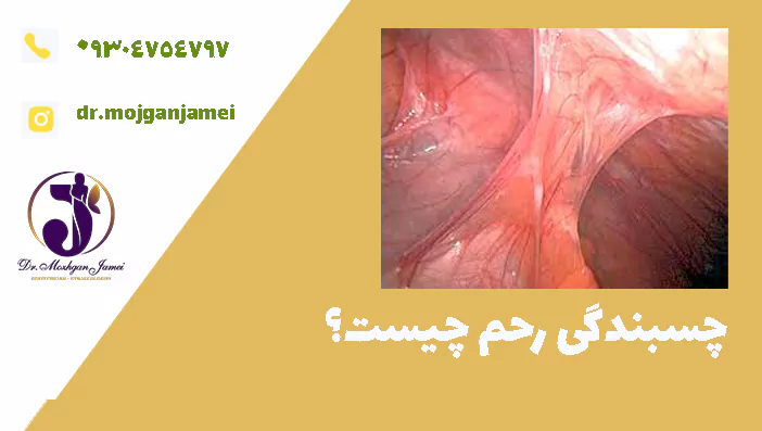 چسبندگی رحم چیست