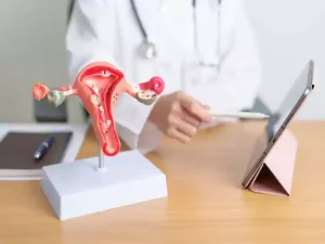 بهترین دکتر فیبروم رحم