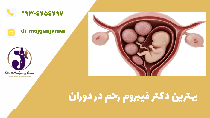 بهترین دکتر فیبروم رحم در دوران 