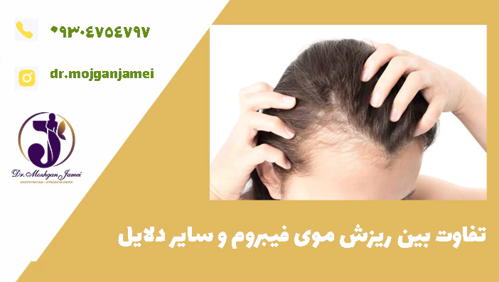 تفاوت بین ریزش موی فیبروم و سایر دلایل