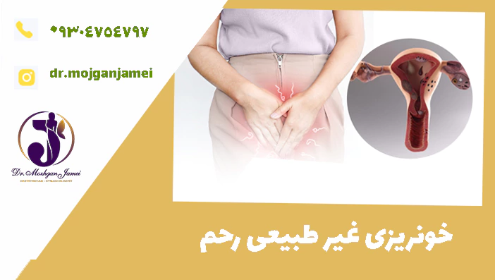 خونریزی غیر طبیعی رحم 