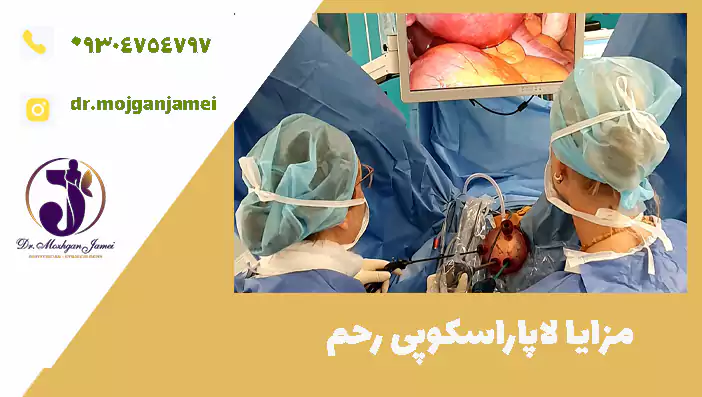 مزایا لاپاراسکوپی رحم 